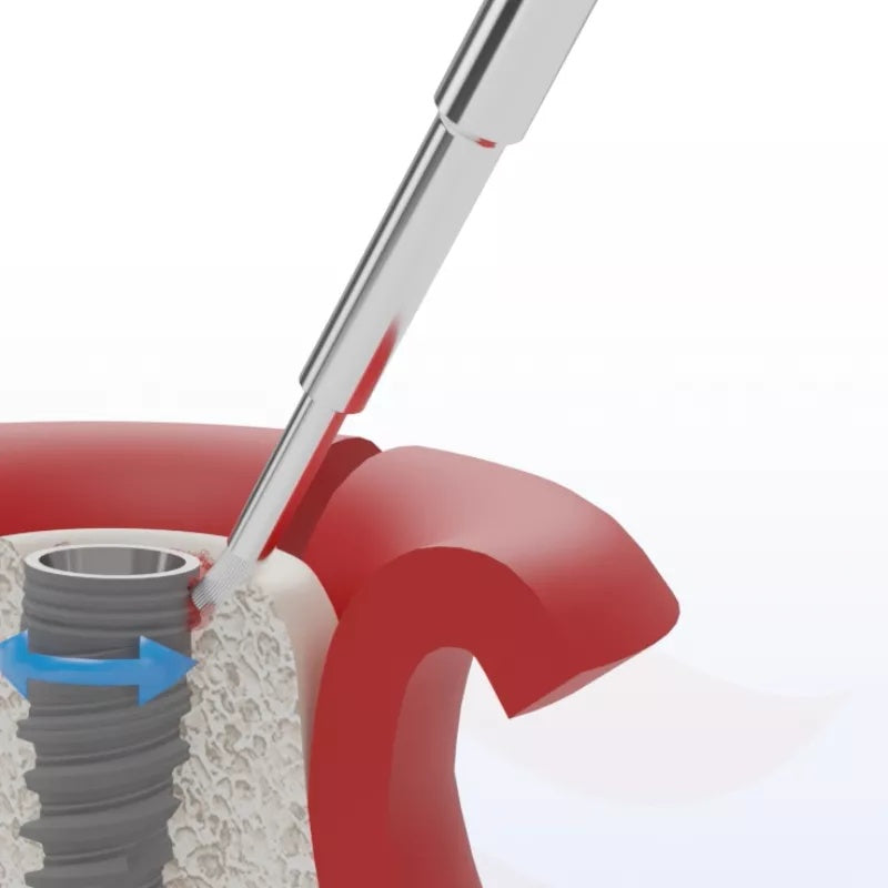 Titanium Brush pentru Implanturi Dentare – Perie pentru Decontaminare în Tratamentul Peri-implantitei image 3