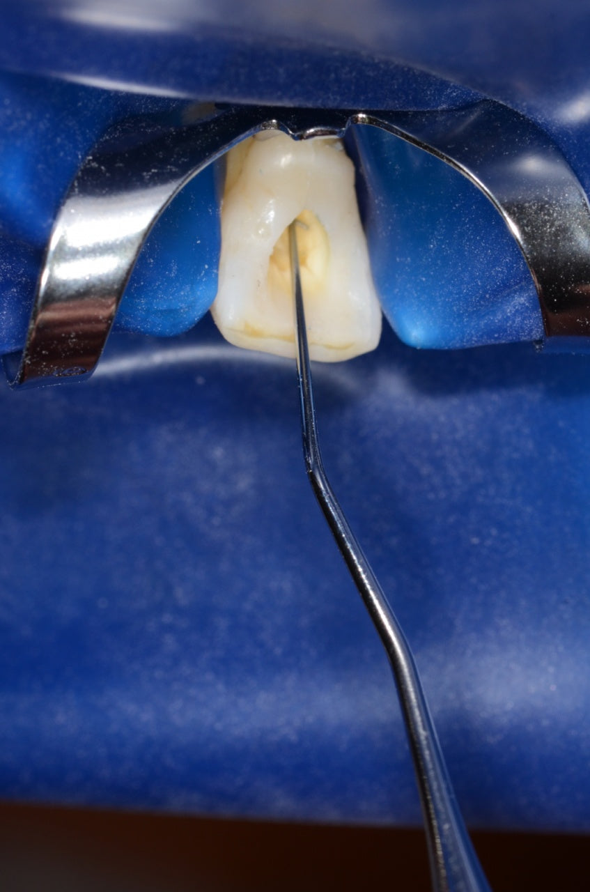 9214 - Sonda endo model 17/17L - KOHLER Dental - imaginea 4