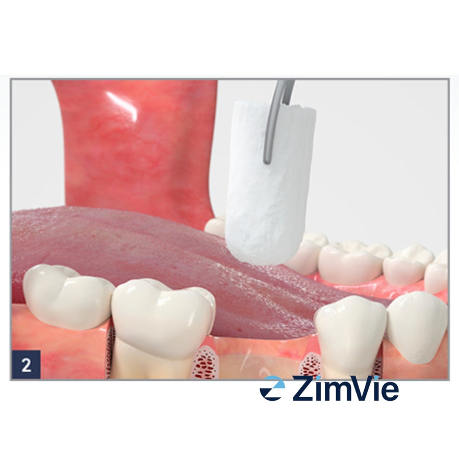 Dop Hemostatic Resorbabil ZimVie Collagen Plug (0102Z) – 10 buc. - imaginea 3