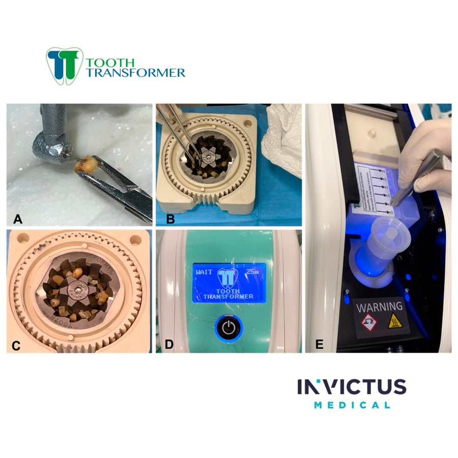 Sistem Automatizat TT Tooth Transformer – Kit Complet pentru Regenerare Osoasă Autologă - imaginea 5